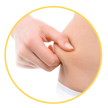 stockage-graisses-lipostim